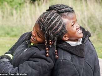 Conjoined twins, Neev and Nelly Kolestein, from Amsterdam, have defied medical expectations by thriving past their initial prognosis. United at the head since birth, they possess separate brains and bodies, sharing a main artery crucial for their survival. Despite enduring challenges and societal prejudices, the twins, now 18, have embraced their unique bond, expressing no desire for separation. Their journey, marked by resilience and determination, has inspired them to raise awareness through social media platforms. Through their YouTube channel and Instagram page, they aim to showcase their lives beyond their medical condition, challenging perceptions and celebrating their individuality. As craniopagus twins, they represent a rare medical phenomenon, constituting only a small fraction of conjoined twins worldwide. While their condition is exceptionally rare and typically carries a grim prognosis, advancements in medical imaging and surgical techniques offer hope for those in similar situations. Originally from Suriname, South America, the twins relocated to the Netherlands in pursuit of specialized medical care. Despite their parents' hopes for separation, medical assessments revealed the complexity of their connection, making separation unfeasible due to shared critical blood vessels and veins. Despite the challenges they've faced and the odds stacked against them, Neev and Nelly continue to defy expectations, standing strong together on their unique journey. Through their unwavering bond and determination, they exemplify the power of resilience and the beauty of embracing one's individuality, inspiring countless others along the way.
