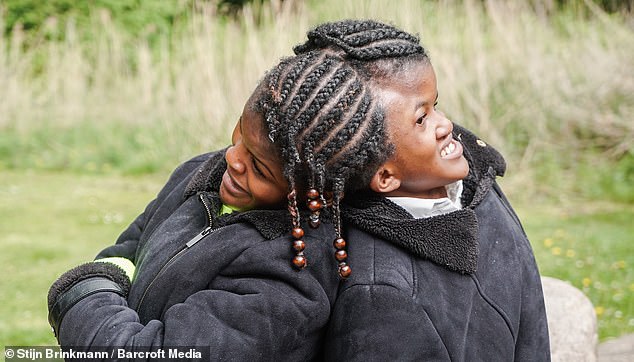 Conjoined twins, Neev and Nelly Kolestein, from Amsterdam, have defied medical expectations by thriving past their initial prognosis. United at the head since birth, they possess separate brains and bodies, sharing a main artery crucial for their survival. Despite enduring challenges and societal prejudices, the twins, now 18, have embraced their unique bond, expressing no desire for separation. Their journey, marked by resilience and determination, has inspired them to raise awareness through social media platforms. Through their YouTube channel and Instagram page, they aim to showcase their lives beyond their medical condition, challenging perceptions and celebrating their individuality. As craniopagus twins, they represent a rare medical phenomenon, constituting only a small fraction of conjoined twins worldwide. While their condition is exceptionally rare and typically carries a grim prognosis, advancements in medical imaging and surgical techniques offer hope for those in similar situations. Originally from Suriname, South America, the twins relocated to the Netherlands in pursuit of specialized medical care. Despite their parents' hopes for separation, medical assessments revealed the complexity of their connection, making separation unfeasible due to shared critical blood vessels and veins. Despite the challenges they've faced and the odds stacked against them, Neev and Nelly continue to defy expectations, standing strong together on their unique journey. Through their unwavering bond and determination, they exemplify the power of resilience and the beauty of embracing one's individuality, inspiring countless others along the way.